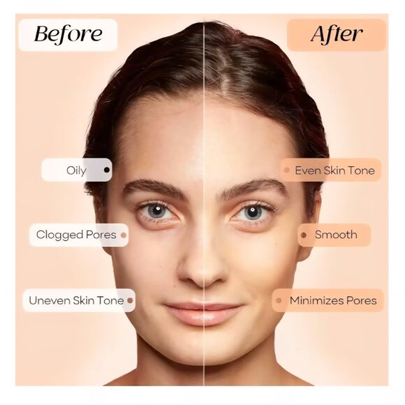 Deep Pore Clay Mask, Blackhead Remover Mask w/ Amazonian White Clay 7oz (200g) - Picture 6 of 10